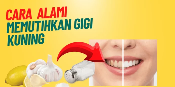 cara memutihkan gigi kuning